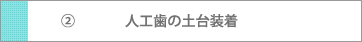 人工歯の土台装着