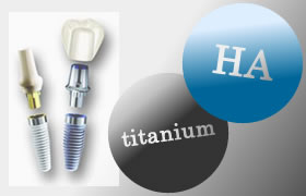 インプラントイメージ